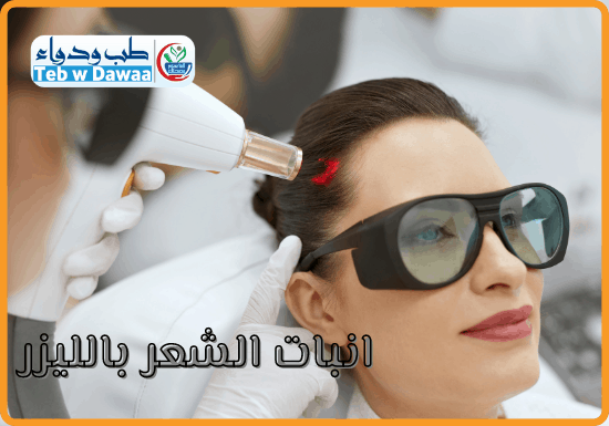 انبات الشعر بالليزر 002