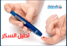 تحليل السكر 001