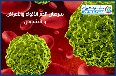سرطان الدم 002