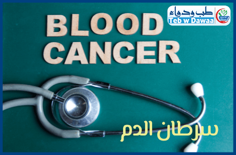 سرطان الدم 001
