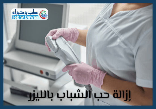 ازالة حب الشباب بالليزر 004