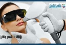ازالة الشعر بالليزر 002