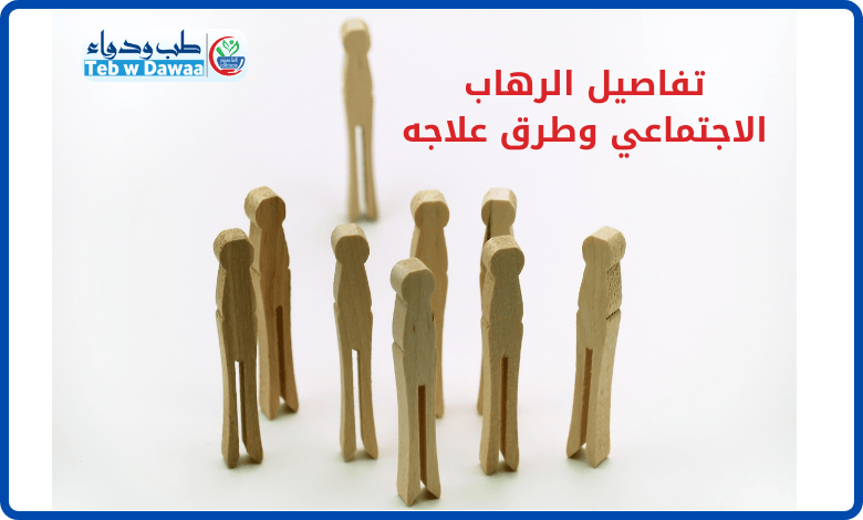 الرهاب الاجتماعي