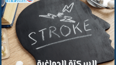 السكتة الدماغية 001