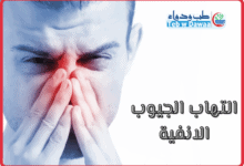 التهاب الجيوب الانفية 001