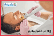 ازالة حب الشباب بالليزر 001