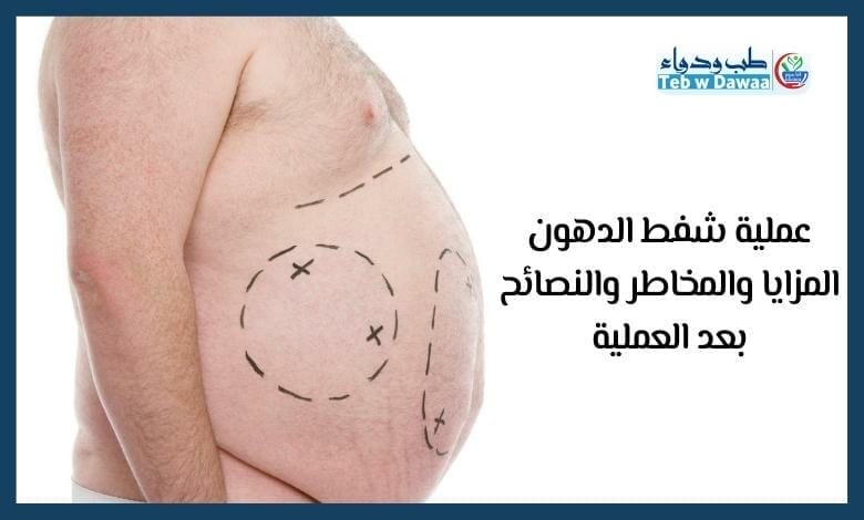 عملية شفط الدهون 002