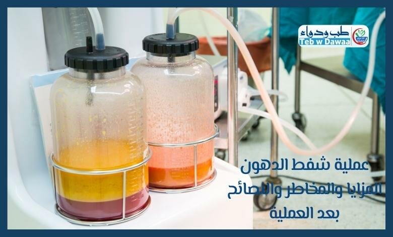 عملية شفط الدهون 003