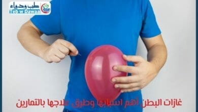 غازات البطن 001