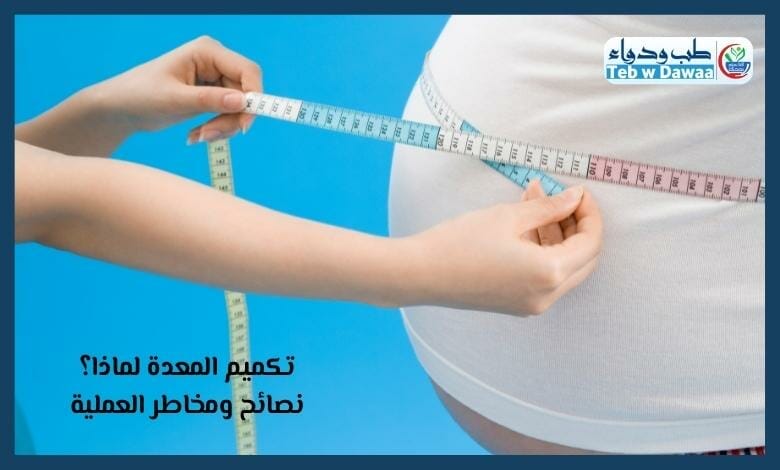 تكميم المعدة 002