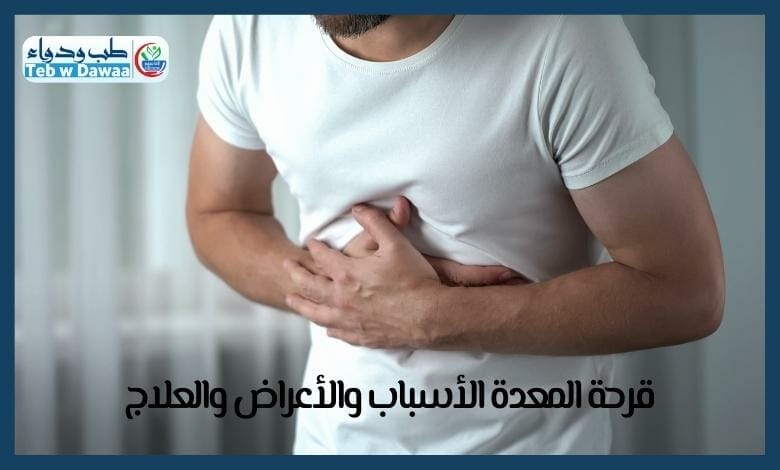 قرحة المعدة 004
